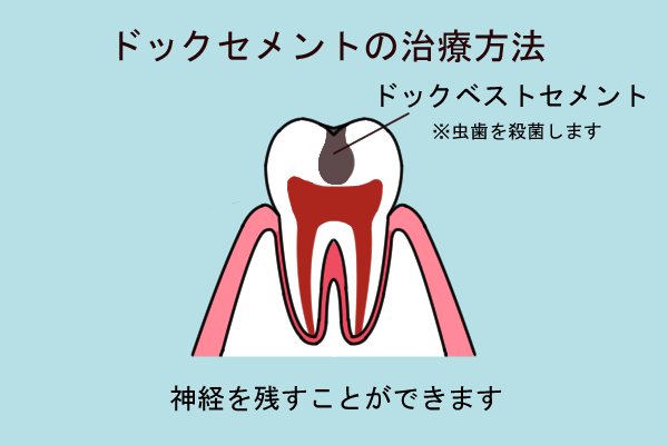 ドッグベスト　イラスト１ - コピー