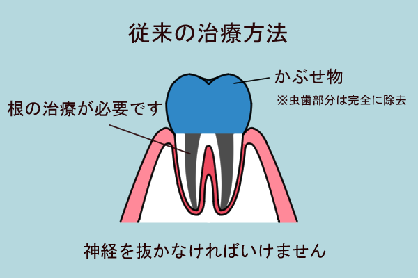 ドッグベスト　イラスト  従来